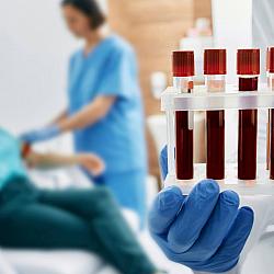 Japão avança no desenvolvimento de sangue artificial universal compatível com todos os tipos sanguíneos