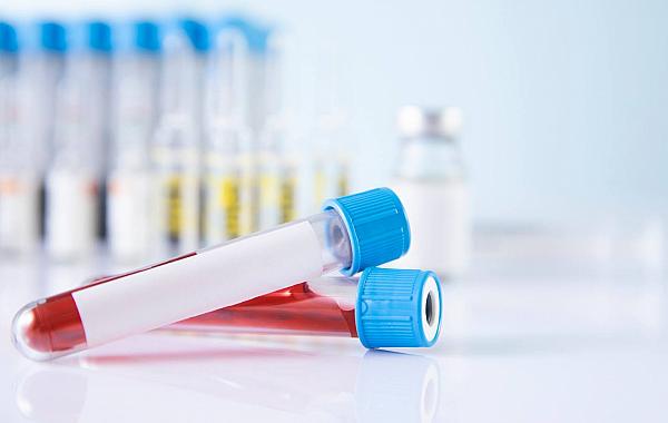 Congresso derruba vetos e torna obrigatório exame toxicológico para categorias A e B