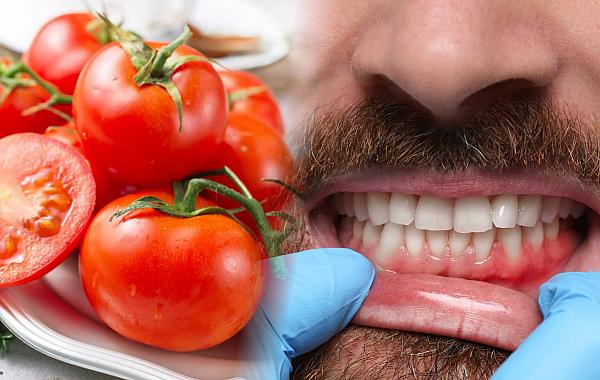 Estudo relaciona baixos níveis de licopeno a maior risco de gengivite em idosos